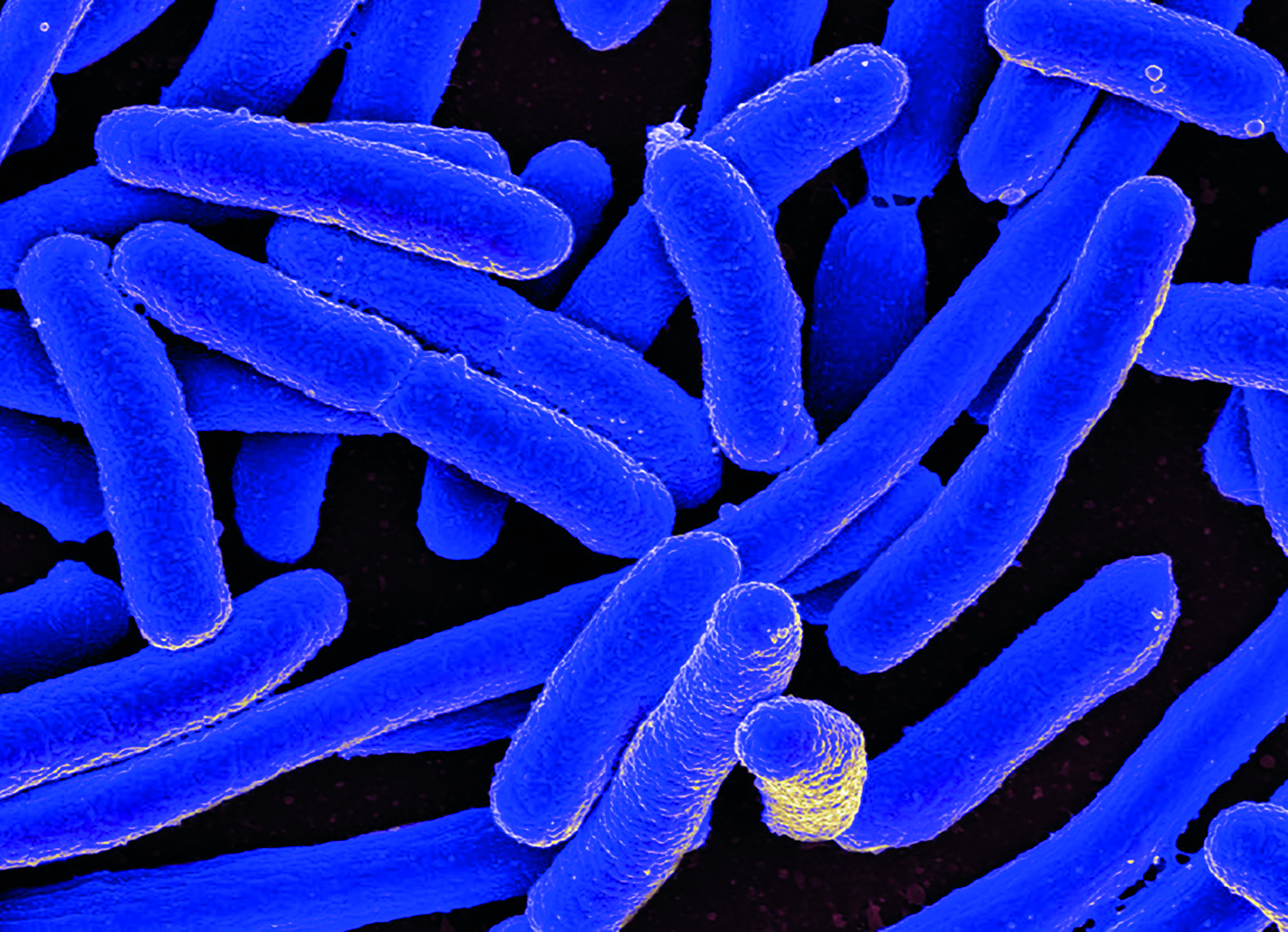 Obr. 2 Bakterie Escherichia coli pod elektronovým mikroskopem [16]